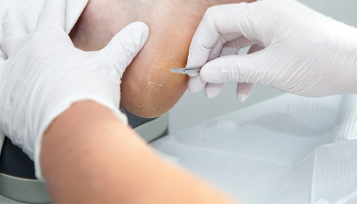 Podólogo en Alicante y Muchamiel. Clinica Podológica en Muchamiel y Alicante.